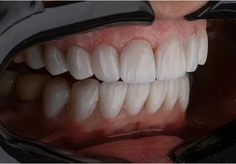 Клинический случай