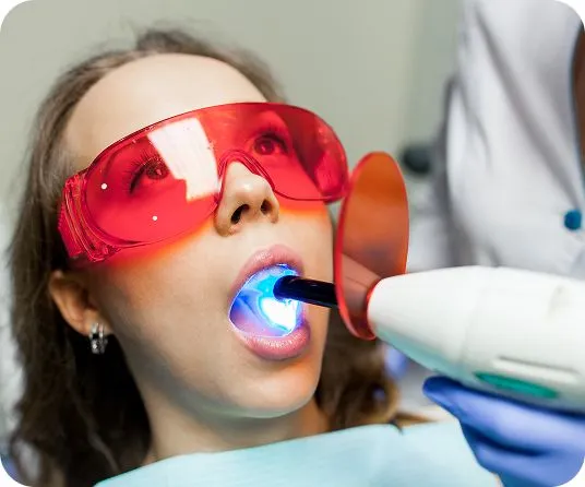 Отбеливание зубов