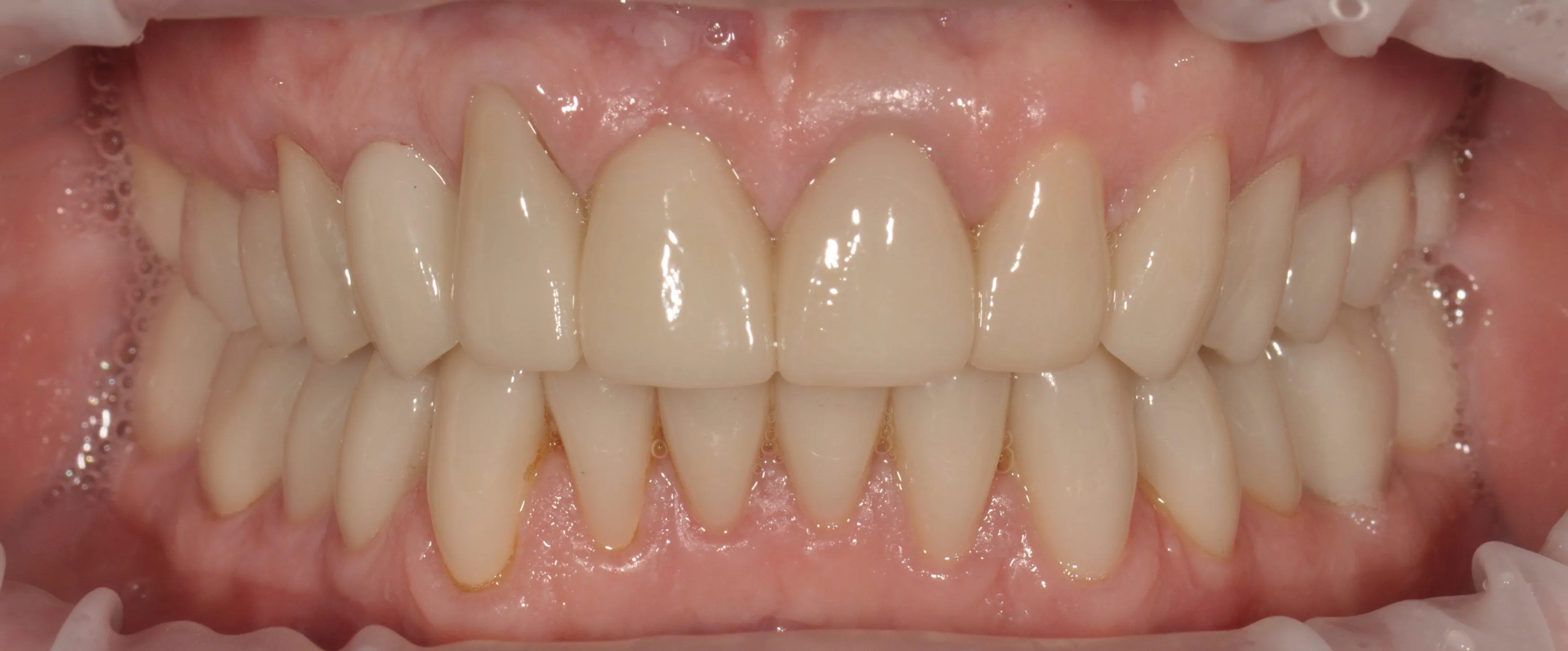 Клинический случай 2